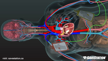 Finnish: AED in Action | A 3D look inside the body