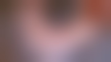 AIOC 2017 - Jaipur - VT42 -Dislocated IOL: Management Pearls!