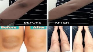 How to lighten DARK KNEES and ELBOWS at home || DIY Treatment || Home Remedies screenshot 5