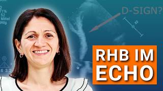 Rechtsherzbelastung Im Echo - Akut Oder Doch Schon Chronisch? - Ausschnitt Sonocoach-Training