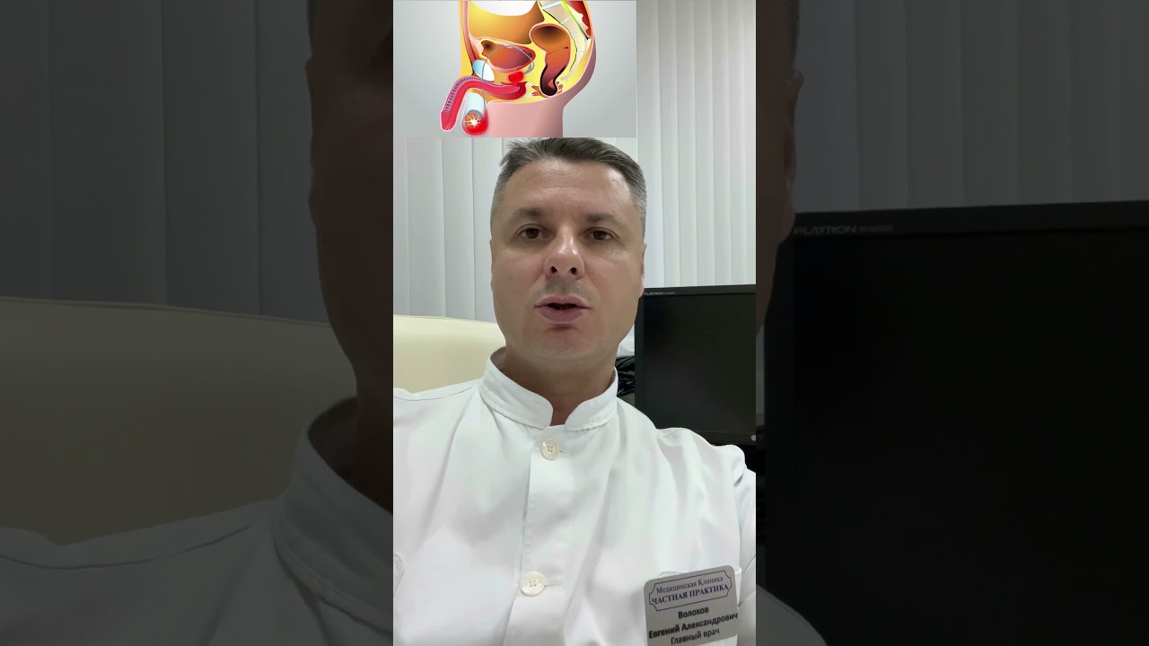 Лейкоциты в сперме