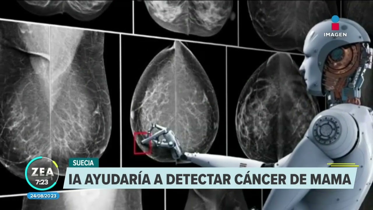 Inteligencia artificial podría facilitar la detección de cáncer de mama | Noticias con Francisco Zea