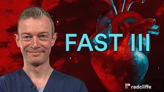 ACC 26: FAST III — FFR vs vFFR to Guide Revascularization