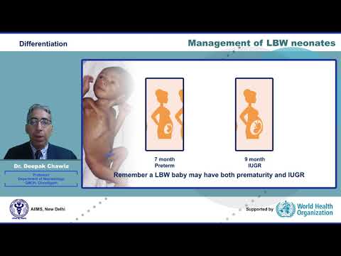 Management of LBW neonates