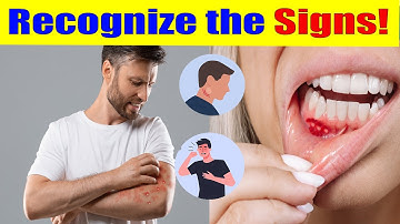 Early Signs of HIV/AIDS: What You Need to Know