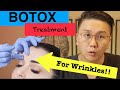 BOTOX TREATMENT FOR FACE WRINKLES