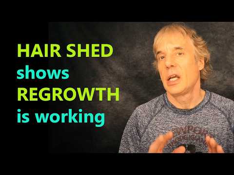 Hair Shedding is GOOD with Regrowth Regimen 