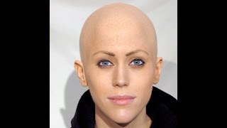 Top 10 bald countries