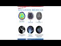Explicacion Escaneos Medicas