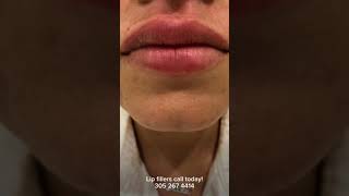 IMG 3855