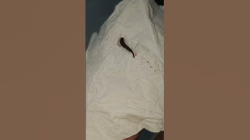 Khi Tui bị con vắt bám vô đùi #cat #funny #animals #pets khethui