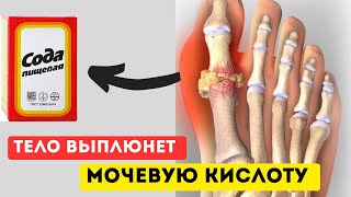 1 ложка НАТОЩАК! Подагру высасывает…Кристаллы Мочевой превратятся в Воду!