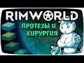 Rimworld Гайд Протезы и Хирургия [Медицина]