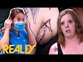 Woman Won't Get Married Until She Has A Mysterious Lump Under Her Arm Removed | Dr. Pimple Popper