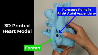 TEER Simulation: DORV with Fontan Anatomy screenshot 4