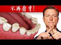 磨牙最佳2種維他命(磨牙症),自然療法,柏格醫生 Dr Berg