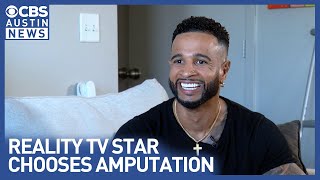 Nelson Thomas Opens Up About Amputation Journey