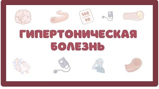 Гипертоническая Болезнь - причины, симптомы, лечение (лекция)