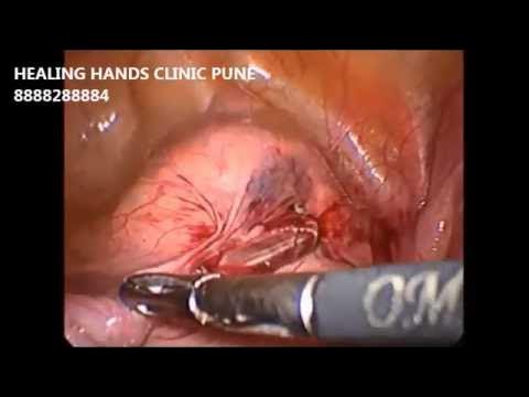 Qor malikasi porno 3-mavsum Vibro mashinasi bilan porno jinsiy aloqa