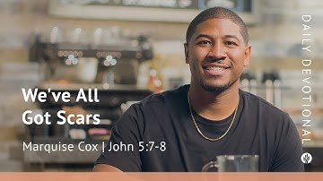 We’ve All Got Scars | John 5:7–8 | Our Daily Bread Video Devotional