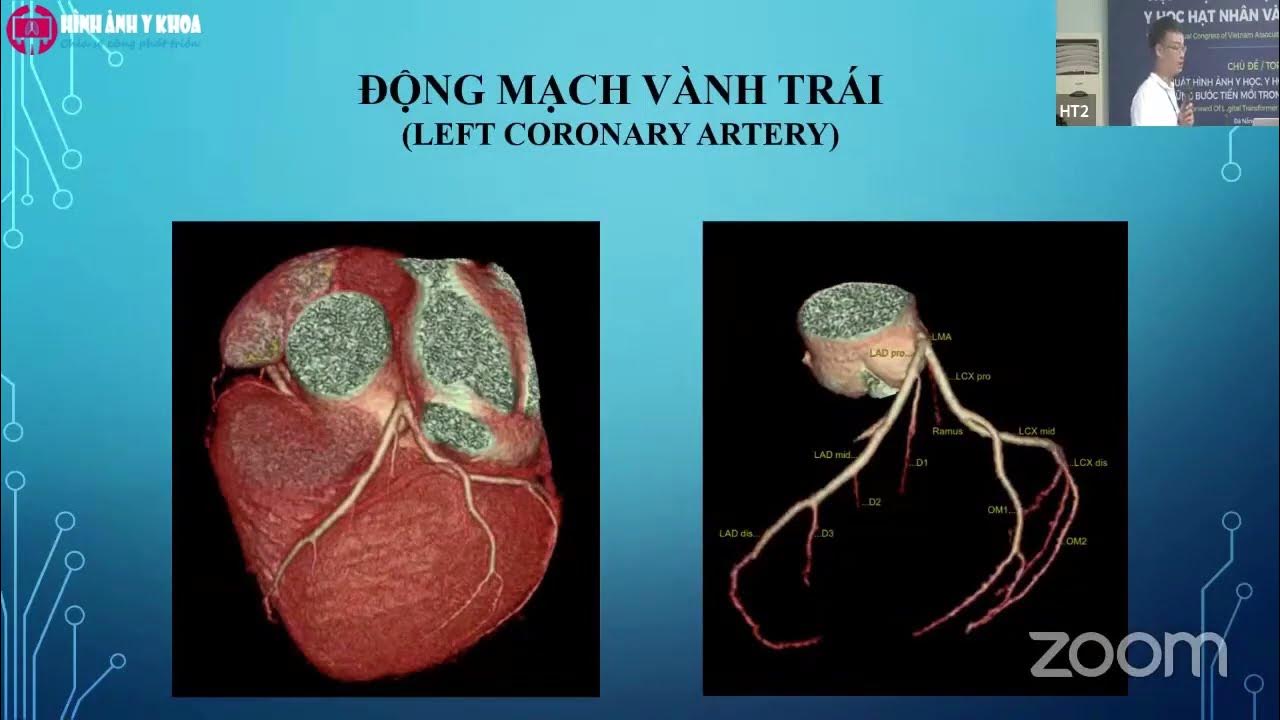 VART 2022] HT2P3-08 Xử lý hình ảnh ĐMV trong thực hành - Những khó ...