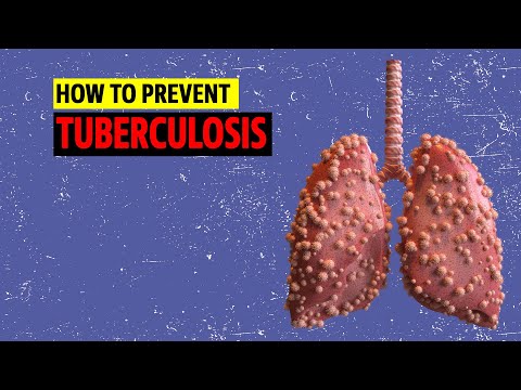 How to Prevent