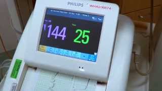 Baby Contraction verses Heart Rate monitor
