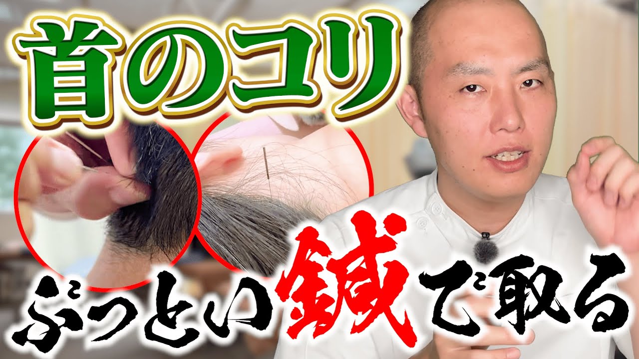 【絶望の首コリ】ぶっとい鍼で取ってみた｜年間8,000人以上を診る銀座の鍼灸師
