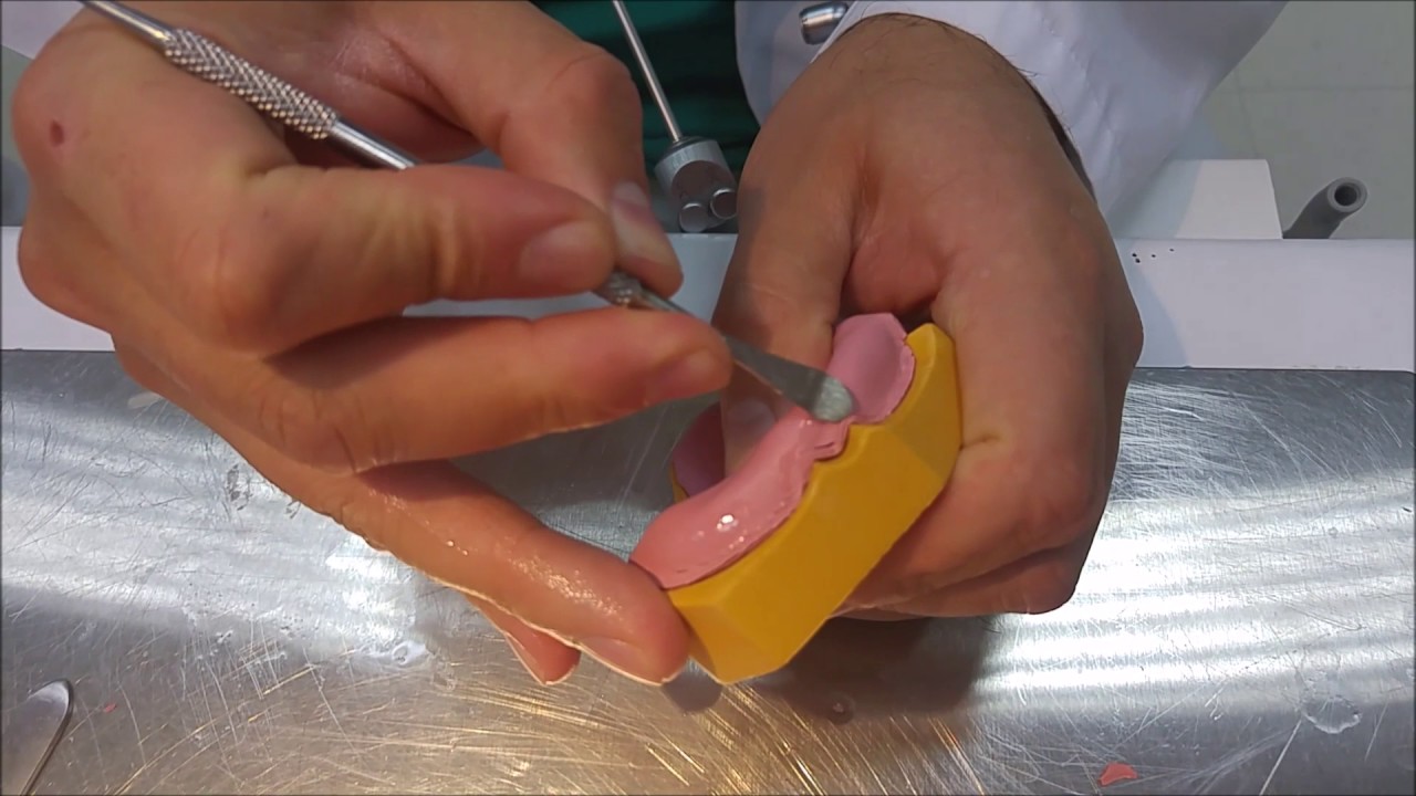 Confección de Placas de Altura en Desdentado Total  2.0