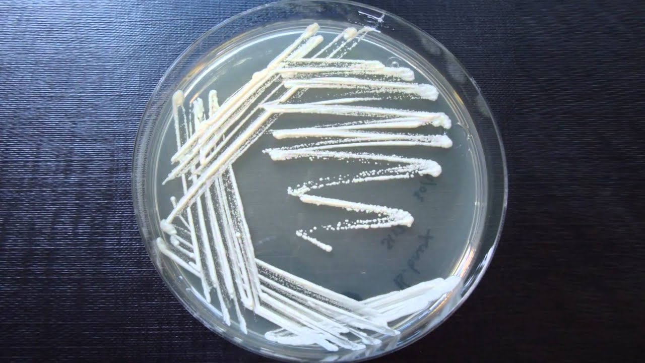 What are the disadvantages of the streak plate method?