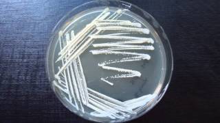 Streak Plate Method - Amrita University