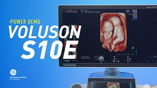 POWER DEMO | VOLUSON S10 EXPERT