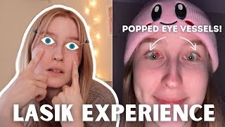 My Lasik Experience: Before, During and Side Effects