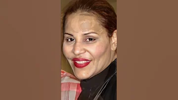 احلام قبل و بعد عمليات التجميل فنان مشاهير فنانات العرب اكسبلور فن تريند فنانين ترند 