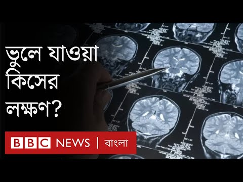 ভিডিও: আপনি কি আপনার ৯০ এর দশকে ডিমেনশিয়া হতে পারেন?