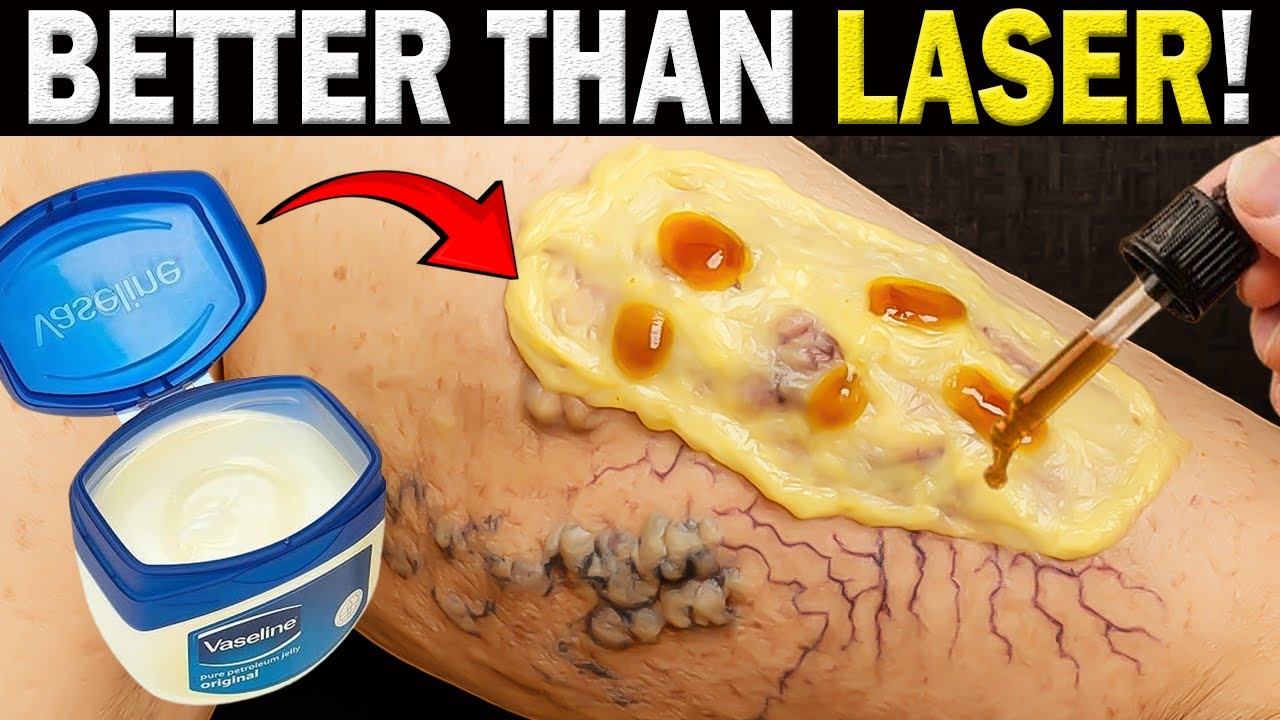 Таких лекарств больше не делают (гвоздичное масло + вазелин).