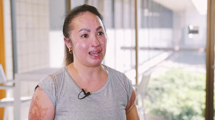 Orthotics and Prosthetics Students and Patients Form Lasting Friendships