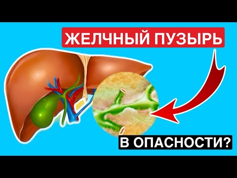 Спасите желчный пузырь!