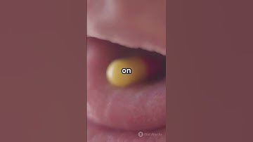 DidYouKnow?YourTongue is asUnique as YourFingerprint #Biometrics#FunFacts #Science #UniqueIdentities