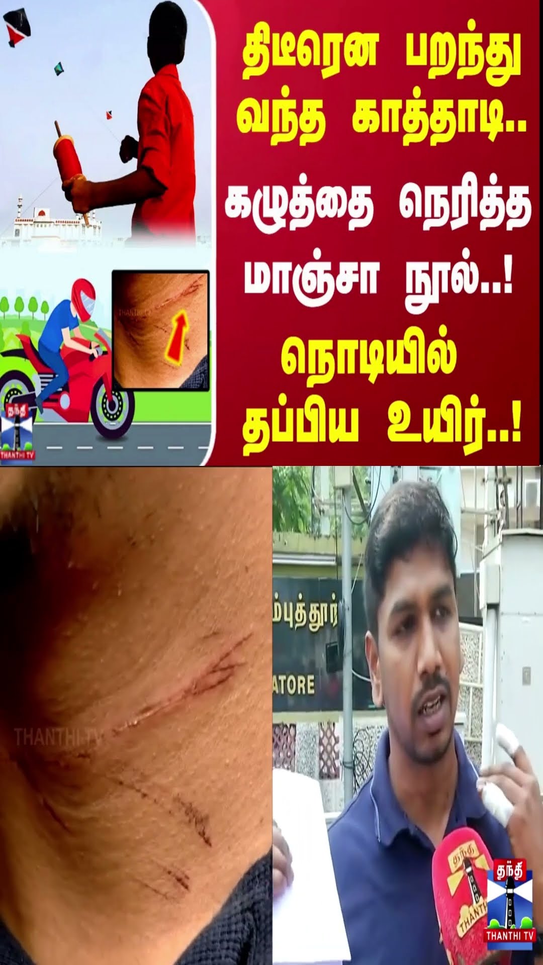 திடீரென பறந்து வந்த காத்தாடி..கழுத்தை நெரித்த மாஞ்சா நூல்..! நொடியில் தப்பிய உயிர்..!
