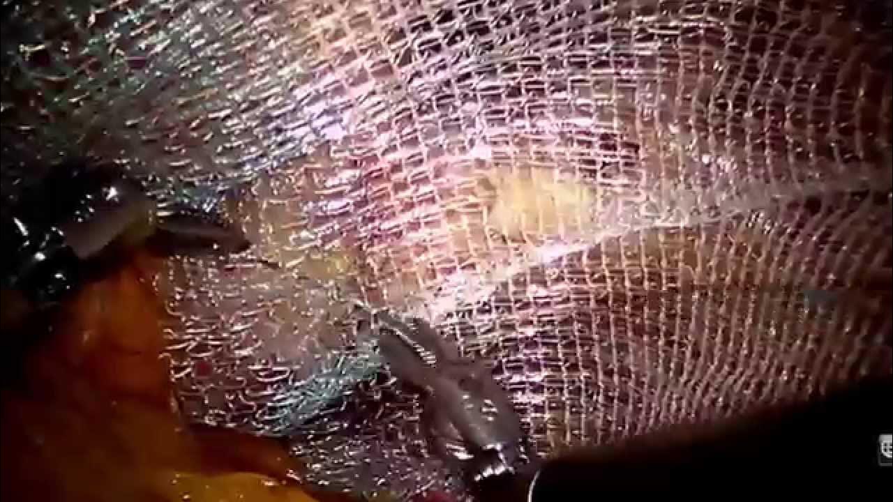 robotic-inguinal-hernia-repair-tapp-youtube