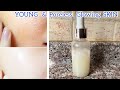Open Pores on Face Treatment at Home | Pore Tightening Home Remedies - Smooth Skin #glassskin 😍 💕