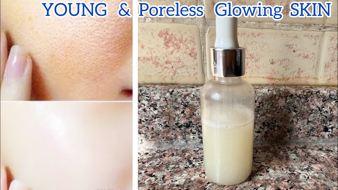 Open Pores on Face Treatment at Home Pore Tightening Home Remedies