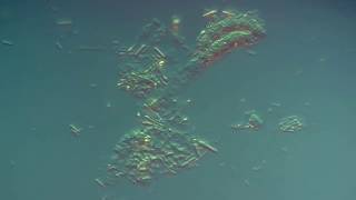 Спорообразующие бактерии, Differential Interference Contrast Спорообразующие бактерии, Differential Interference Contrast