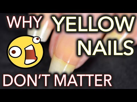 Why yellow nails DON&rsquo;T MATTER / Don&rsquo;t whiten your nails