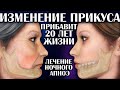 Изменение прикуса прибавляет 20 лет жизни. Лечение ночного апноэ. 3 серия.