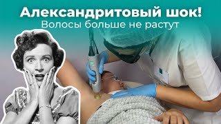 Александритовый шок! Лазер, который в 2 раза быстрее уничтожает волосы