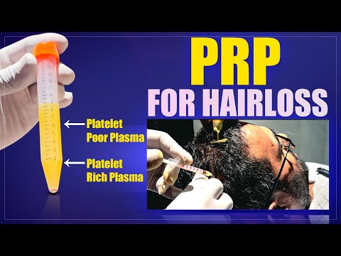 PRP Hair Treatment In Bangalore | NEW ROOTS |