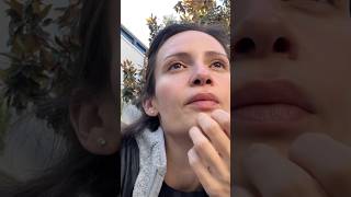 Sick surgeon #doctor #surgeon
Teaser from the most recent vlog! Have you seen it yet?
WATCH HERE
https://youtu.be/XnG4dPcm74s?si=hLDg-DYWvk_KyW
#vlog #medicine #residency Sick surgeon #doctor #surgeon