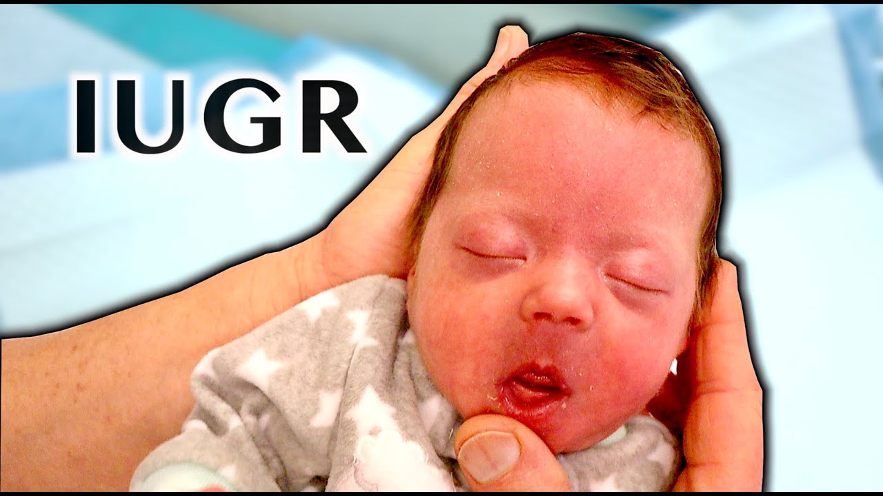 Iugr Baby Weight Gain After Birth Kids Matttroy
